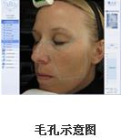 VISIA�沿�D������x�aƷ��B