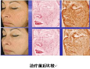 VISIA�沿�D������x�aƷ��B