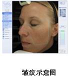 VISIA�沿�D������x�aƷ��B