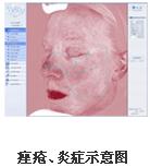 VISIA�沿�D������x�aƷ��B