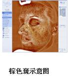 VISIA�沿�D������x�aƷ��B