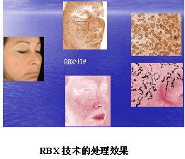 VISIA�沿�D������x�aƷ��B